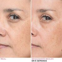 Bye Bye Lines Concentrated Sérum 30ml-205826 Bye Bye Lines Concentrated Sérum 30ml-205826 2